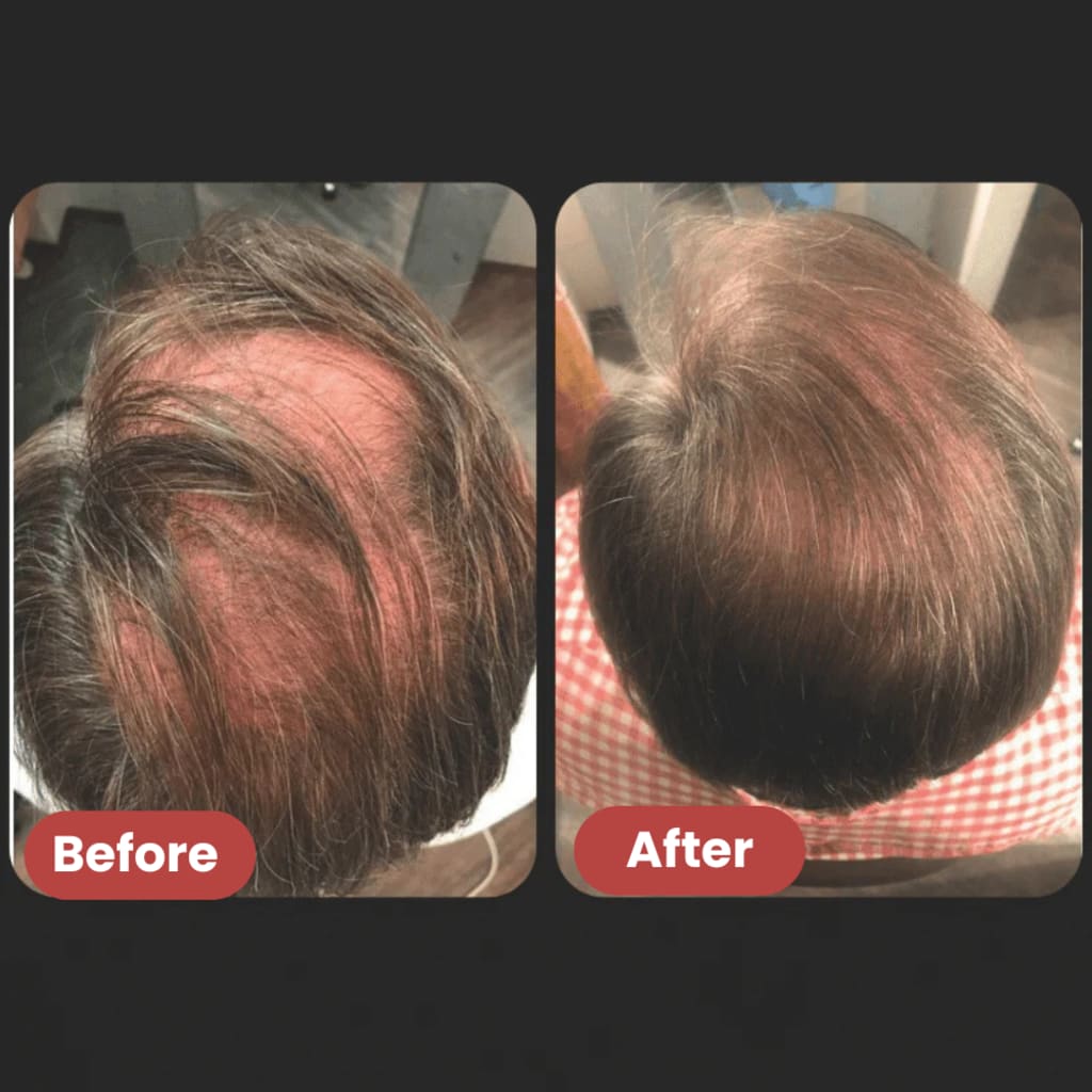 GlowEase Roll On Serum